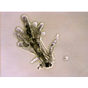 0301_ameba2.jpg<>Ameba je protist, ki živi v vodi. Nekatere vrste ameb so povzročitelji bolezni.