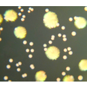 0303_bakterije_enterococcus.jpg<>Na posebej pripravljenem gojišču za gojenje bakterij so se namnožile skupine bakterij, imenovane kolonije. Vsaka izmed kolonij (rumenih pik) se je v nekaj dneh razvila iz ene same bakterije.