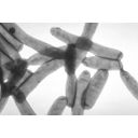 0303_bakterije_legionella.jpg<>Bakterija legionela živi v celinskih vodah in je potencialno nevarna, če se prekomerno razmnoži. Takrat lahko povzroči pljučnici podobno bolezen.