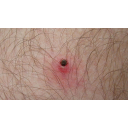 0318_klop.jpg<>Klop zajeda sesalce, tudi človeka.